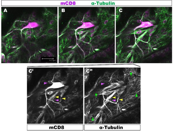 Figur 1