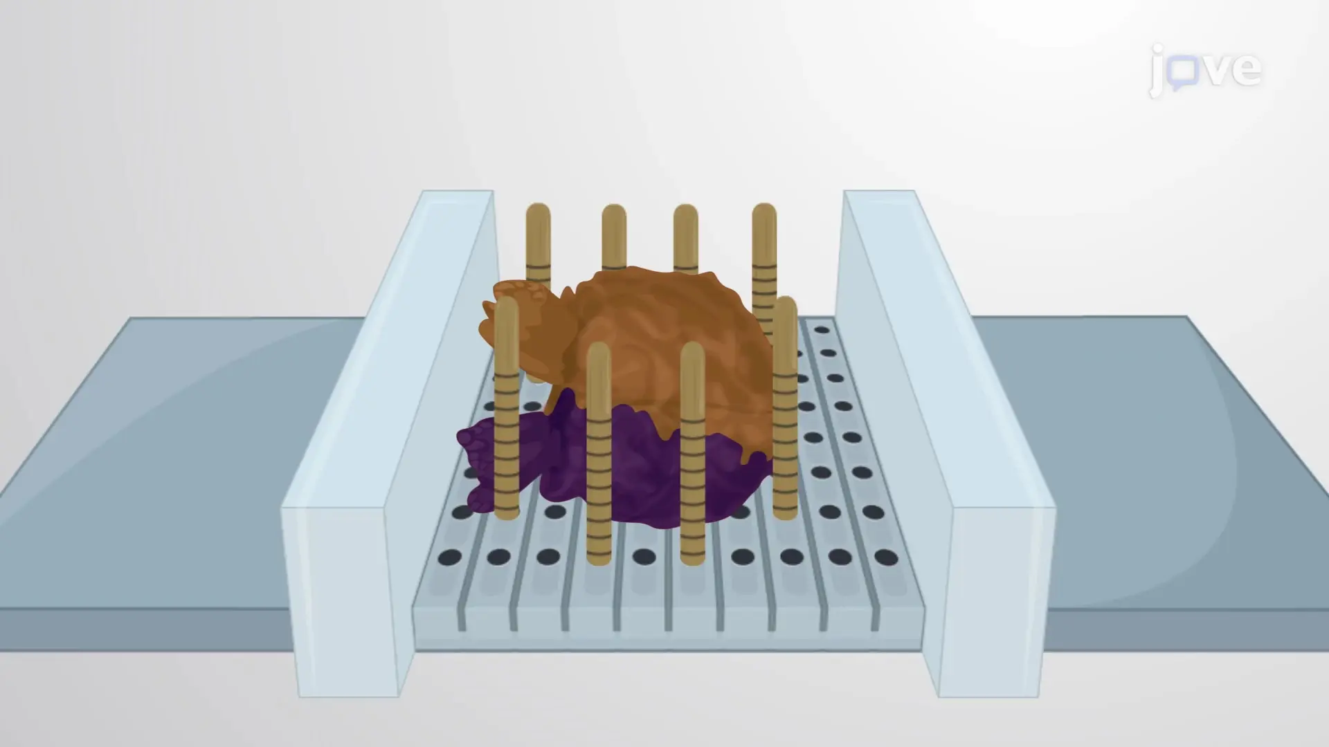 Sampling Prostate Cancer Tissue for Biobanking: An MRI-guided Targeted Technique to Remove Biopsy Punches from Fresh Tumor Tissue
