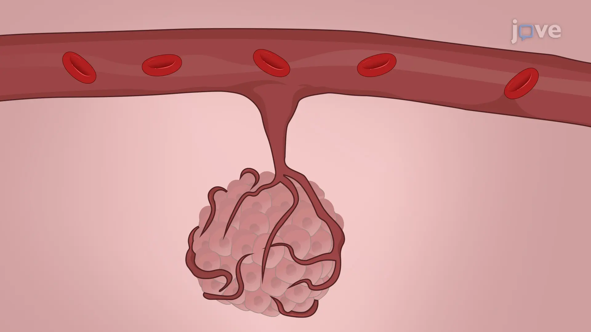 Brain Tumor Stem Cell (BTSC) Migration Assay for Drug Treatment Studies: An In Vitro Live-cell Imaging Technique to Analyze the Effect of Drug Treatment on Migration of BTSCs