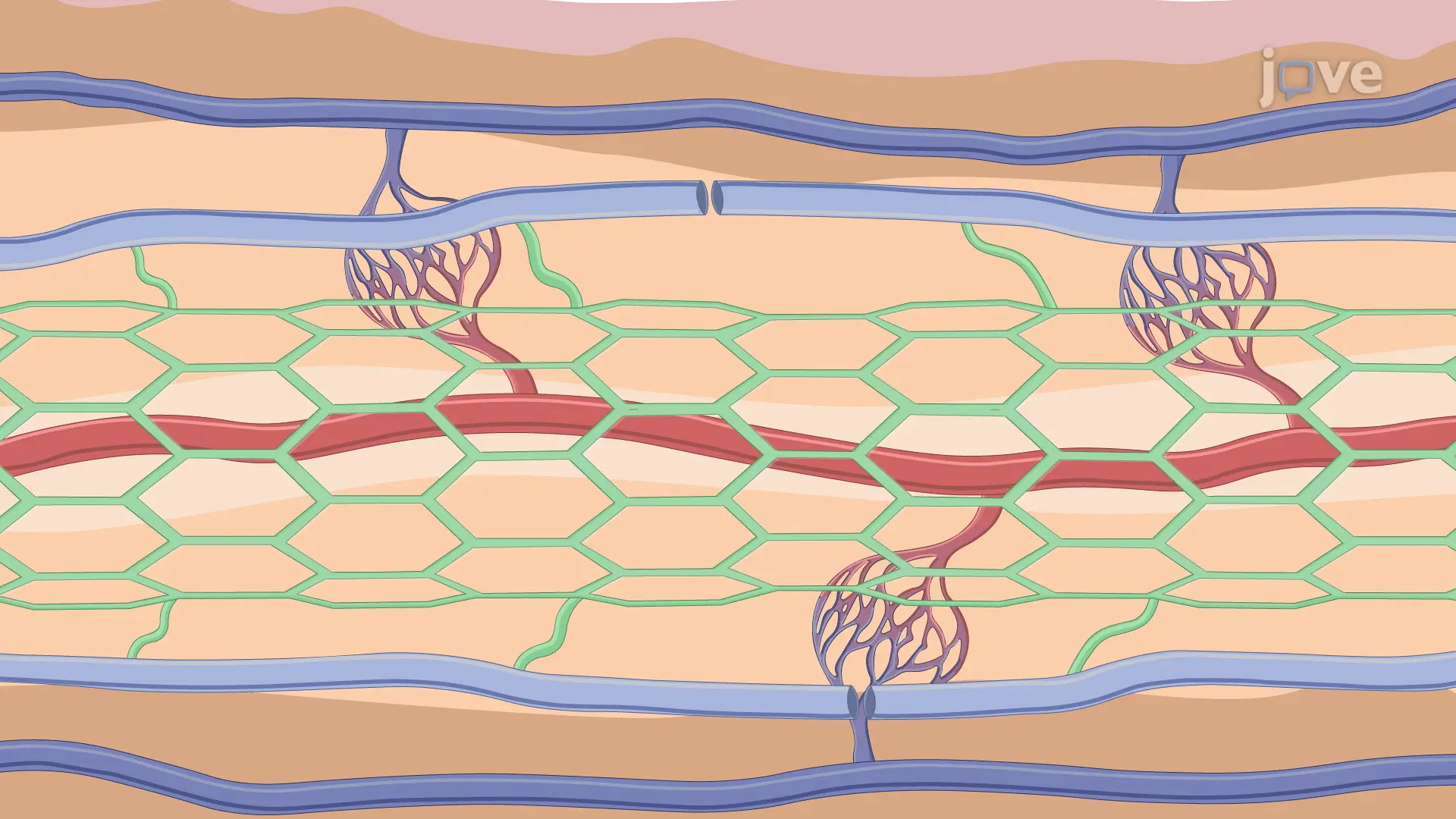 Murine Tail Lymphedema Model: An In Vivo Technique to Generate Sustained Lymphedema in Murine Tail