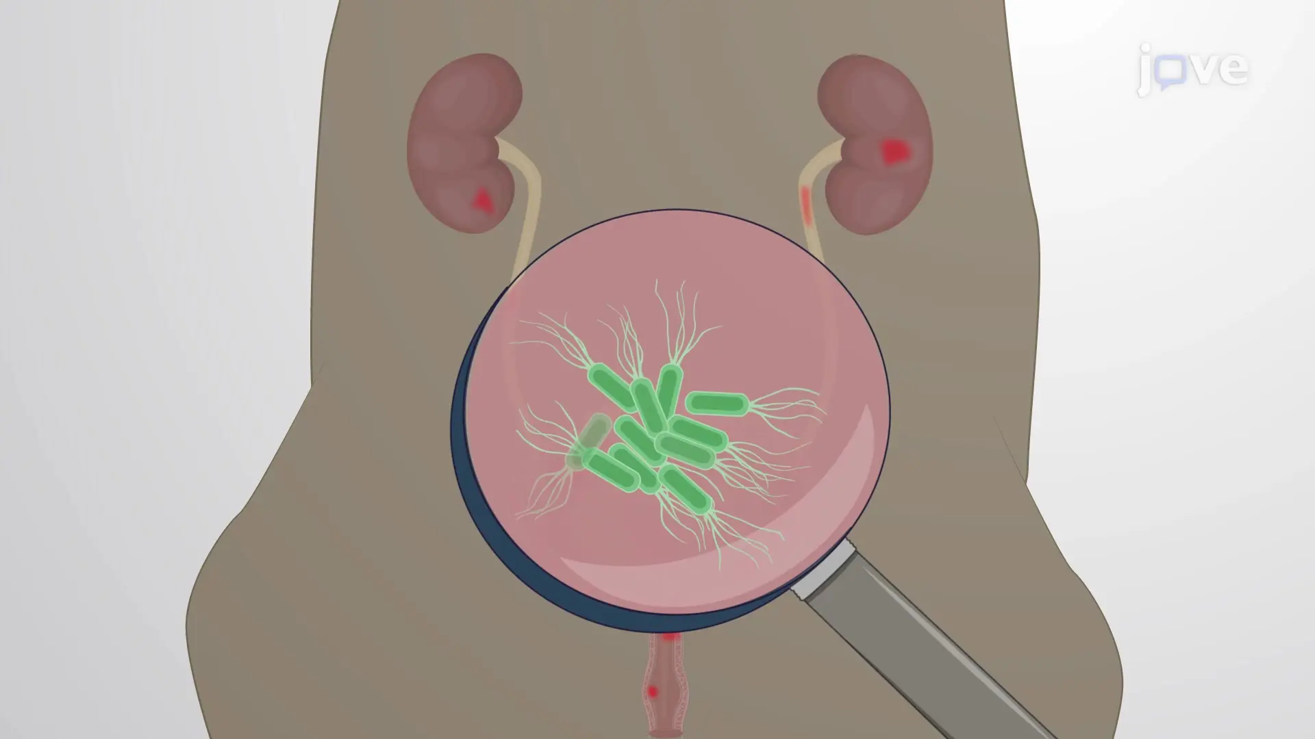 Generating Urinary Tract Infection Model: A Technique to Administer Uropathogenic Bacteria in Mouse to Develop Urinary Tract Infection Model