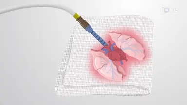 Ex vivo Lung Perfusion: A Technique for Pulmonary Research in a Rabbit Model
