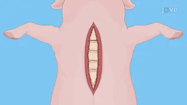 Porcine Heart Excision: A Protocol to Extract Porcine Heart for Cardiac Transplant