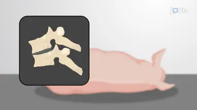 Laser Doppler Needle Probe Insertion: A Technique for Real-time Quantification of Blood Flow within the Spinal Cord in a Porcine Model