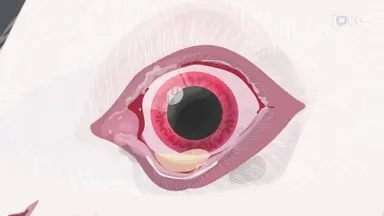 Nictitating Membrane Removal: A Surgical Procedure to Remove Nictitating Membrane from Rabbit Eye