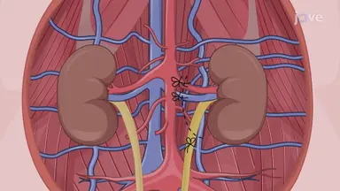 Nephrectomy in a Porcine Model: A Surgical Procedure to Retrieve Porcine Kidney Graft for Transplantation
