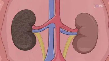 Orthotopic Porcine Kidney Transplantation: A Technique to Transplant Graft Kidney in Porcine Model