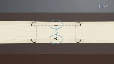 Q Suture Technique: A Suturing Technique to Reduce Gap Formation and Increase Tensile Strength in Tendon Repair