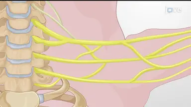 Exposing Brachial Plexus: A Surgical Technique to Visualize Brachial Plexus in Neonatal Piglet
