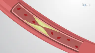 Assessing Vessel Perfusion via Angiography: A Technique to Introduce Contrast Agent in Descending Aorta to Visualize Blood Vessel Perfusion in Rabbit Model