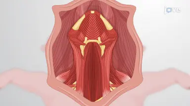 Automated Periodic Stimulation Electrode Installation: A Technique to Surgically Implant An Automated Stimulation Device on the Vagus Nerve in a Porcine Model