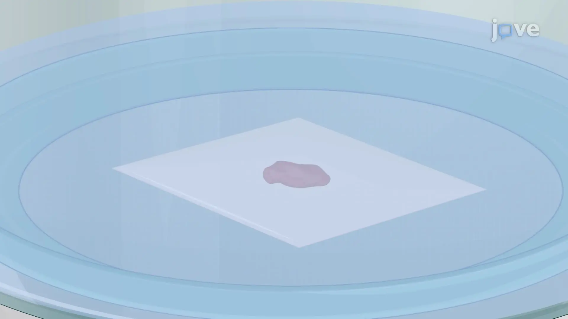 Generating and Maintaining Slice Cultures from Human Glioblastoma Tissue