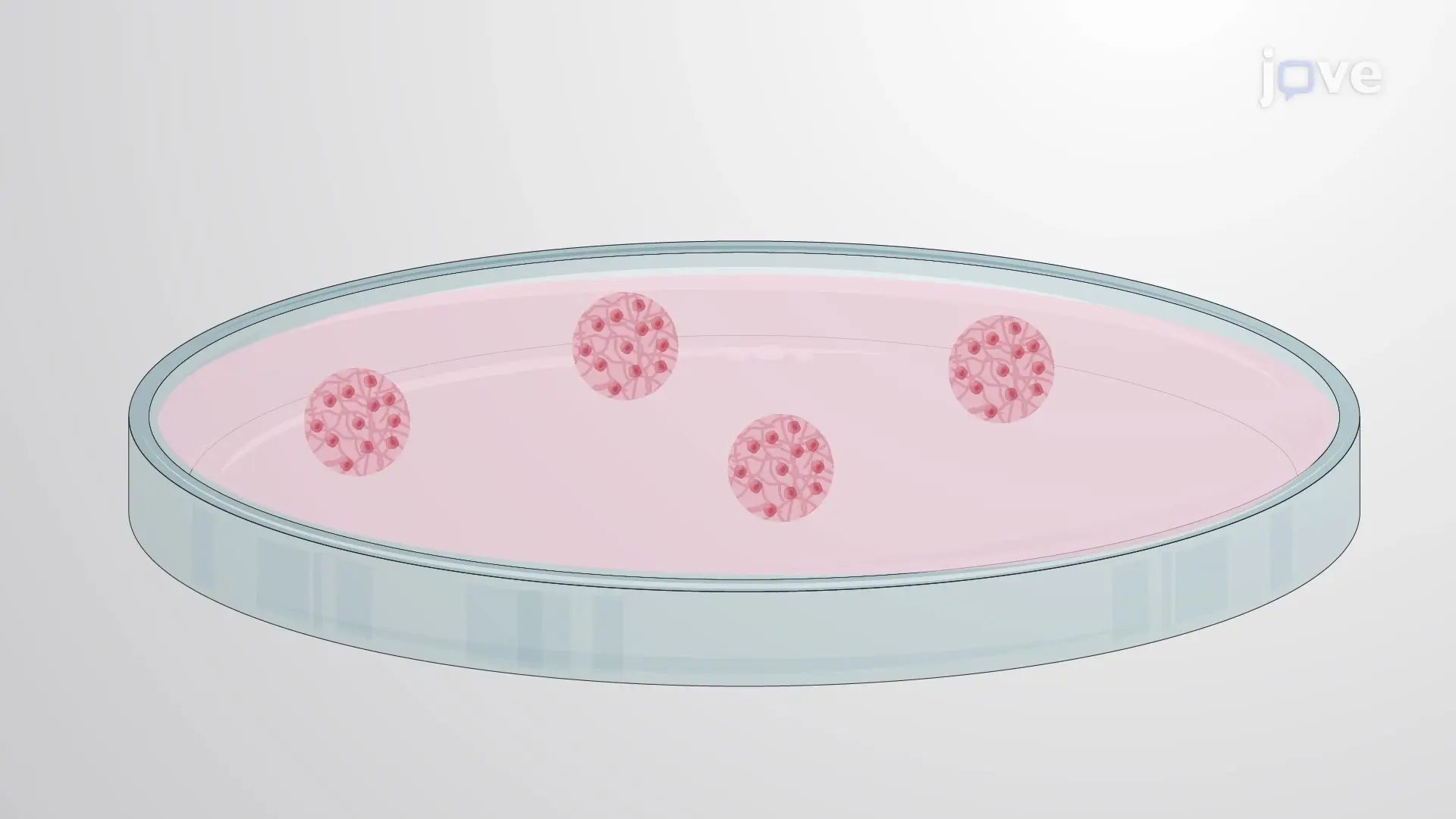 Generating an Organoid Culture from a Brain Tumor Cell Suspension