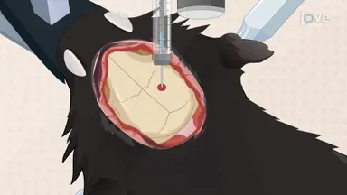 通过溶血磷脂酰胆碱的两点注射建立局灶性脱髓鞘小鼠模型