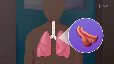 Gene Therapy