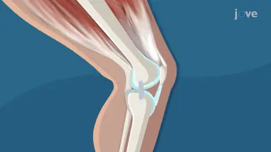 Structure of Bone