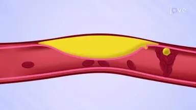 Cardiovascular Diseases