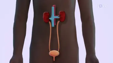 Excretory System Diseases