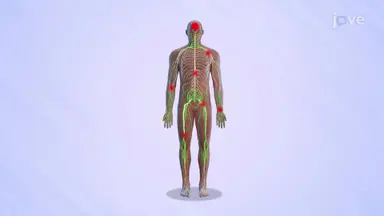 Nervous System Diseases