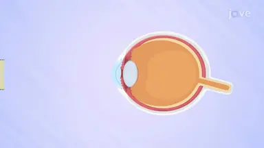 Eyes