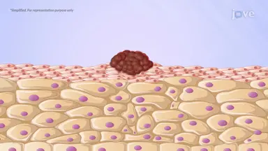 What is Cancer?