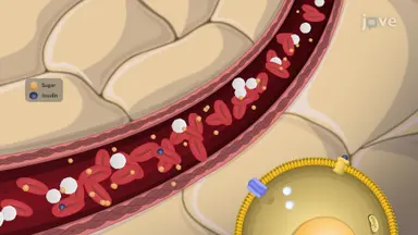 Type I Diabetes