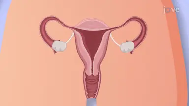 Overview of Female Reproductive System