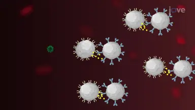 HIV AIDS