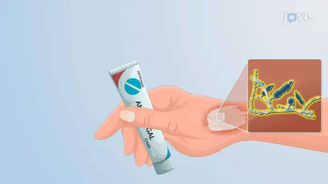 Fungal and Parasitic Infections