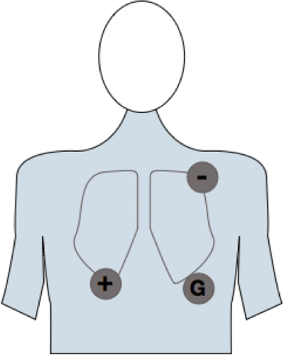 ECG lead placement diagram; electrodes on chest for heart electrical activity measurement.