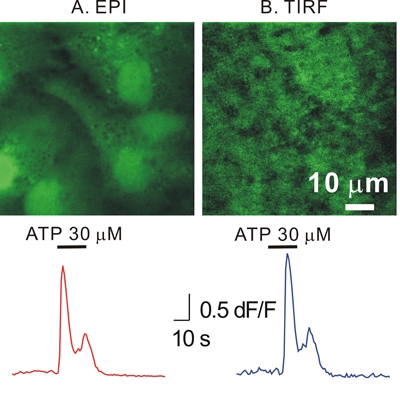 figure-protocol-5 Fluorescence microscopy comparison, EPI vs. TIRF; ATP response, intensity graph, 10 µm scale bar.