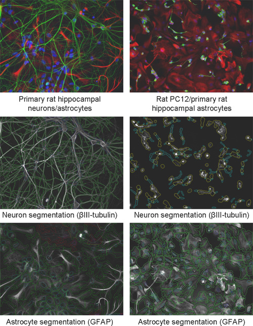Neuronal and astrocyte segmentation results in rat hippocampal cultures; βIII-tubulin, GFAP markers.