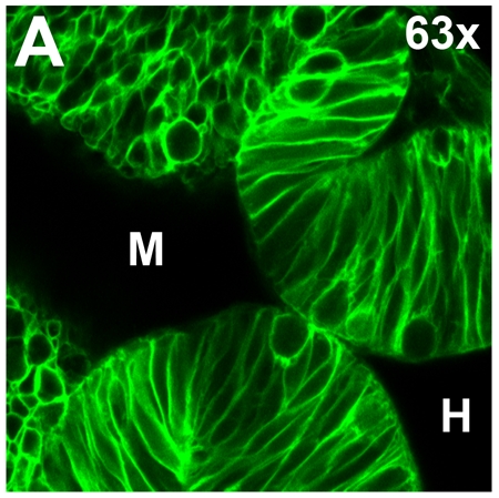 Fluorescence microscopy, cellular structure, 63x magnification, protein localization, biological analysis.