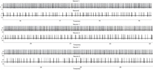 Electrophysiology recordings chart showing neuronal activity with spike train data analysis.