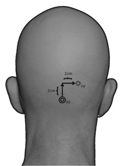figure-protocol-1 figure-protocol-1