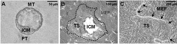 figure-protocol-2 胚胎发育阶段;ICM、TS显微图像;细胞结构分析。
