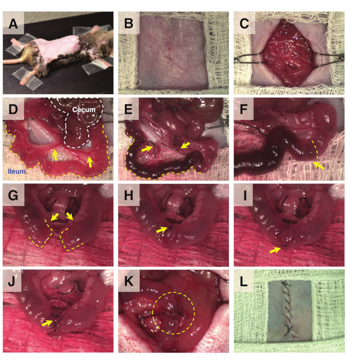 Surgical procedure on rat ileum; step-by-step intestinal anastomosis technique with sutures visible.