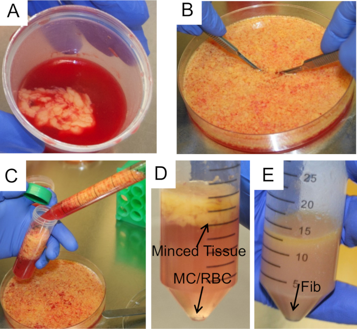 Adipose tissue processing for cell isolation; steps include mincing and centrifuge separation.