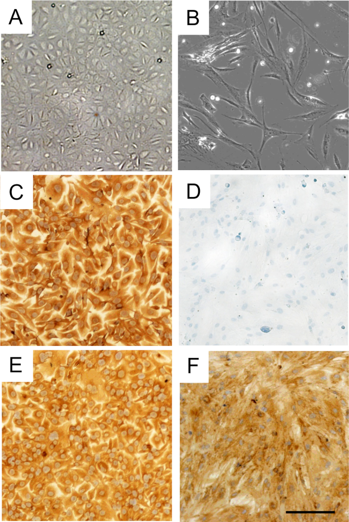Mesothelial Cell Isolation: A Technique to Isolate Primary Mesothelial ...