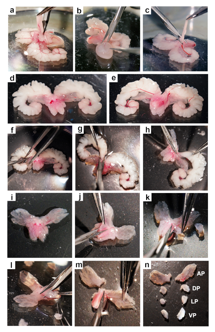 figure-results-1 Brain dissection process, step-by-step method using tweezers for anatomical study, labeled sections.