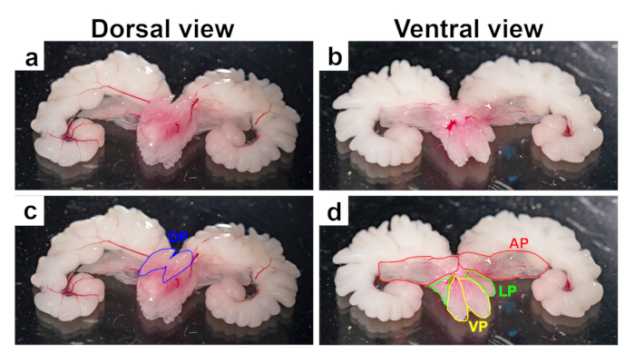 Dorsal and ventral brain anatomy, labeled regions, comparative diagram, educational use.