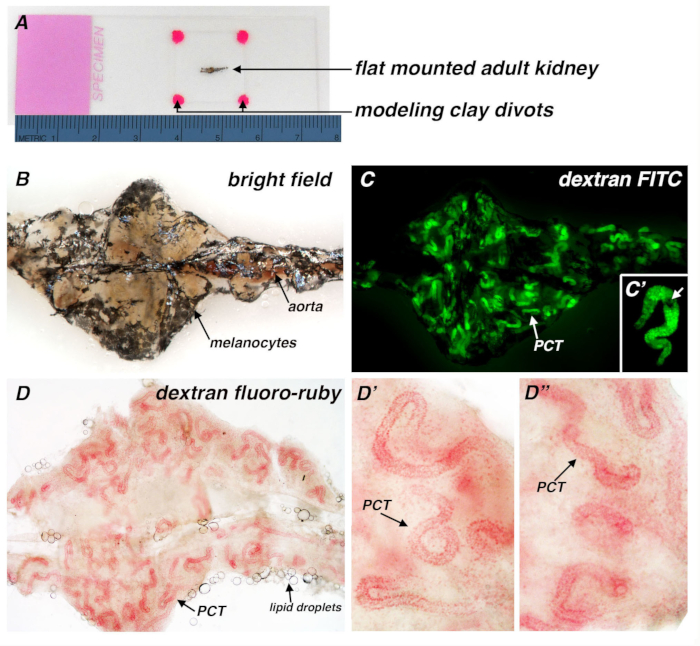 Kidney microscopy; bright-field, dextran FITC; PCT analysis; fluoresces microscopy; microscopy images.
