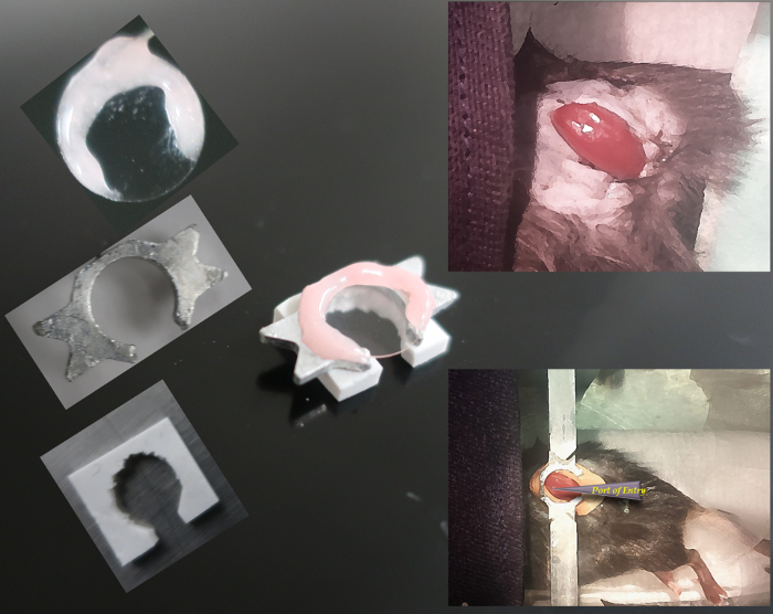 Orthodontic device for dental correction, featuring 3D modeling and dental fitting simulation.