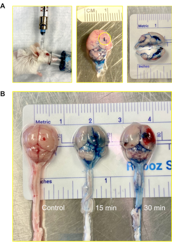 figure-results-3 Mouse brain uptake study, dye injection, experimental setup, time-lapse analysis, comparative results.