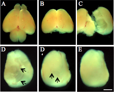 Brain injury assessment; series of rodent brain images; post-trauma analysis; histological study.