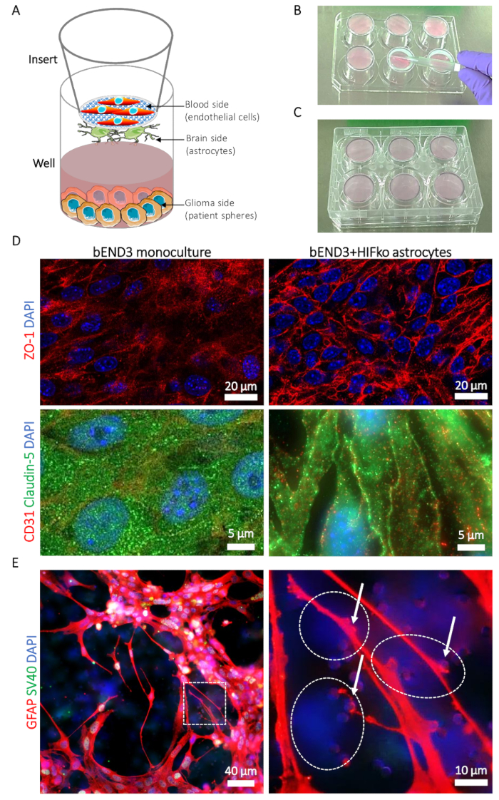Blood-brain barrier model diagram; endothelial cells, astrocytes; fluorescence microscopy results.