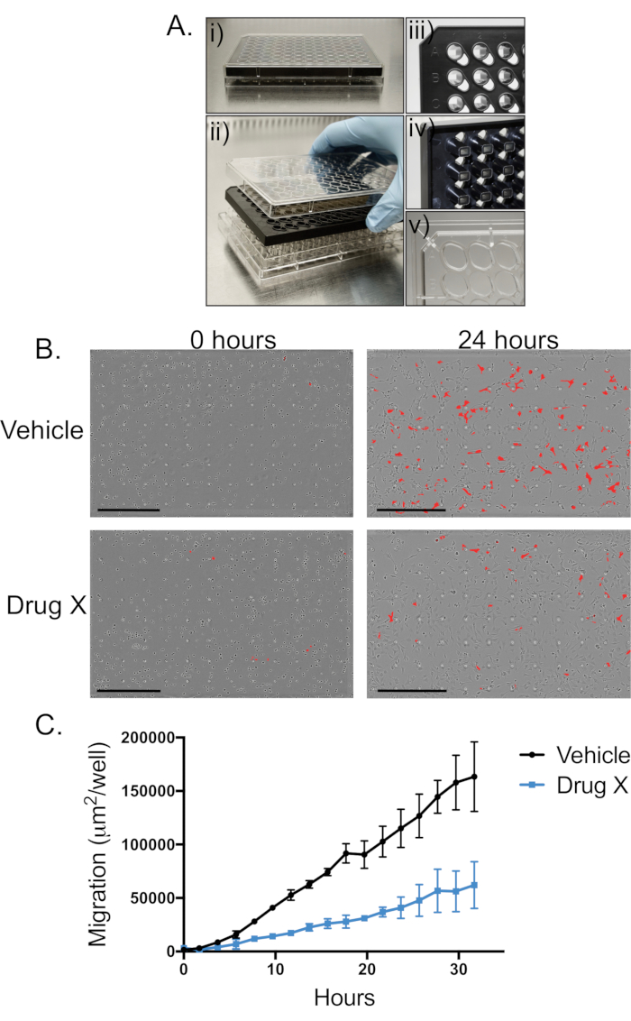 figure-results-1 Cell migration assay setup; microplate with inserts; results at 0-24 hours; migration graph comparison.