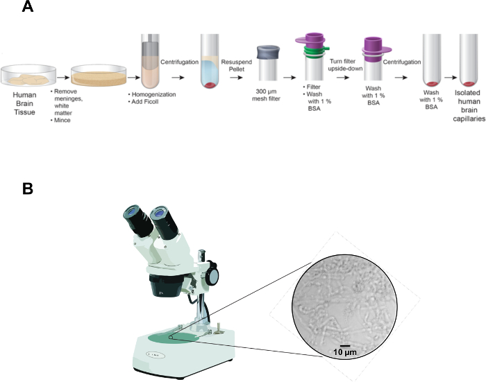 Human brain capillary isolation process diagram and microscope setup for tissue examination.