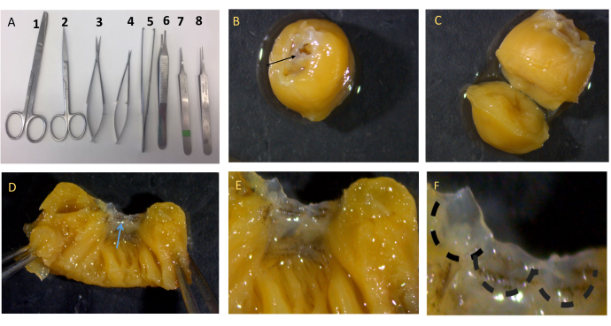 Dissection process with surgical tools and chickpea seed dissection, microscopic tissue analysis.