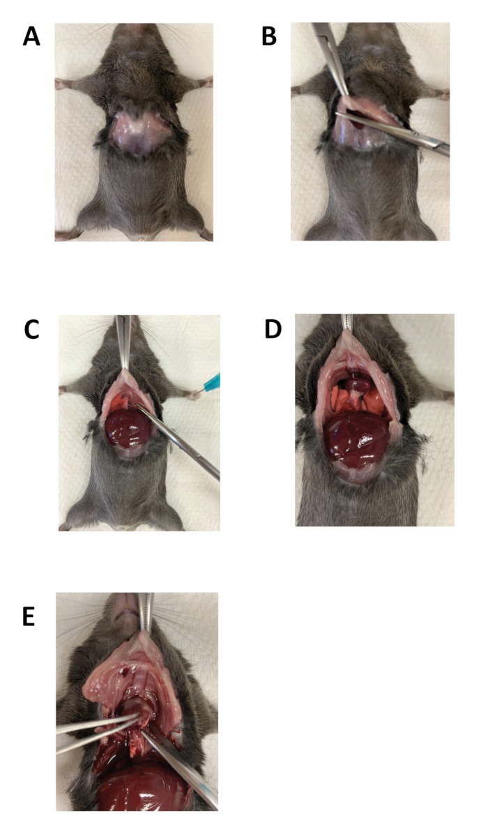 Dissection process diagram of mouse abdominal cavity for liver extraction in laboratory experiment.